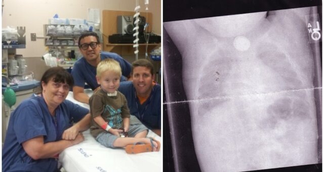 Junge überlebte 65 Operationen, weil er ein Detail verschluckt hatte. Quelle: Screenshot Youtube